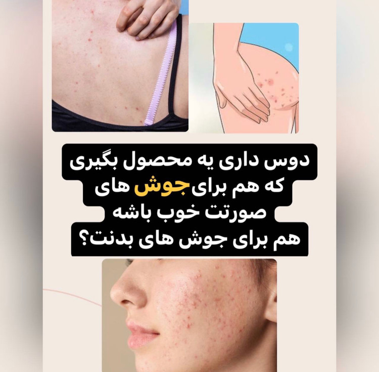 سرم روشن کننده و لایه بردار تخصصی صورت و بدن AHA
