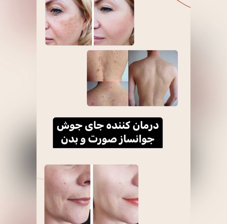 سرم روشن کننده و لایه بردار تخصصی صورت و بدن AHA